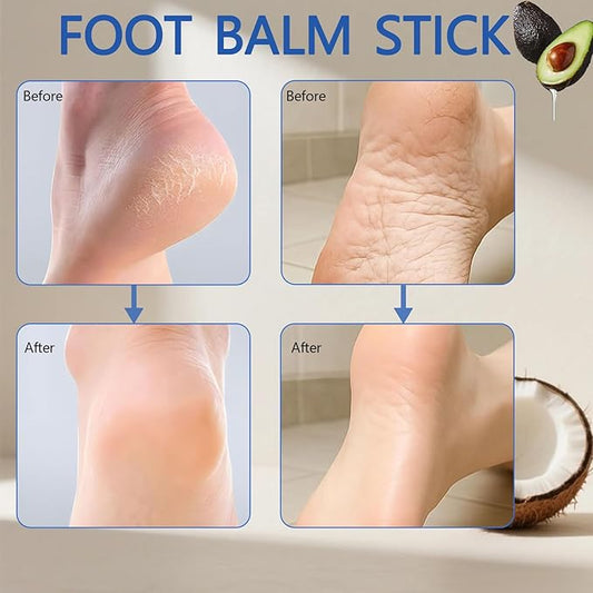 2Pcs Crack Feet Prevention Stick, Hydrating Heel Balm for Dry Cracked Feet,Moisturizing Foot Care Cream, Foot Balm Stick Intensive Repair Feets,Hands,Heels,Elbow and Knees and Softening Dry Skin