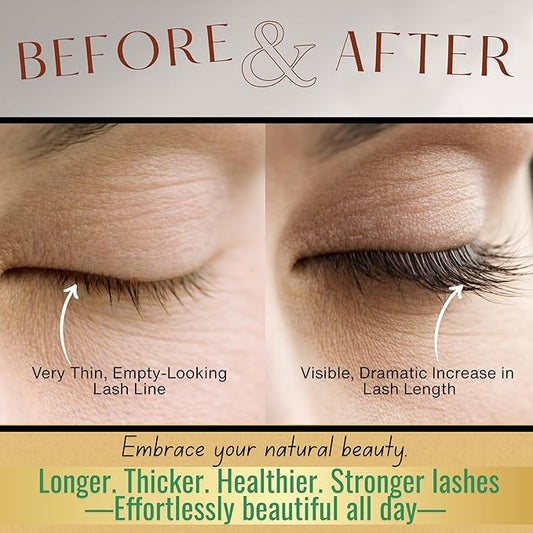 Eyelash Growth Serum - Advanced Biotin, Peptides & Botanical Extract Lash Enhancing Serum for Longer, Thicker Lashes and Brow, Visible Results in 2 Weeks - Hormone-Free, Non-Irritating Formula, 5ml