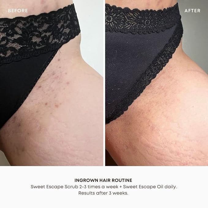 Bushbalm Ingrown Hair and Razor Bumps 2-Step Routine - Moisturize and Calm - Ingrown Hair Oil (30 ml) and Exfoliating Scrub (236 ml) - Sweet Escape