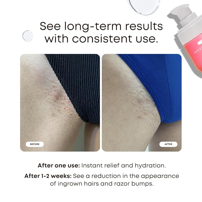 Bushbalm Ingrown Hair and Razor Bumps Routine - Moisturize and Soothe After Shave Skincare for Sensitive Areas - Includes Ingrown Hair Oil (30 ml) and Exfoliating Scrub (236 ml) - Watermelon Sugar