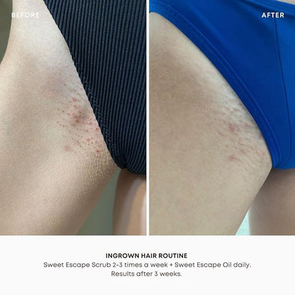 Bushbalm Ingrown Hair and Razor Bumps 2-Step Routine - Moisturize and Calm - Ingrown Hair Oil (30 ml) and Exfoliating Scrub (236 ml) - Sweet Escape