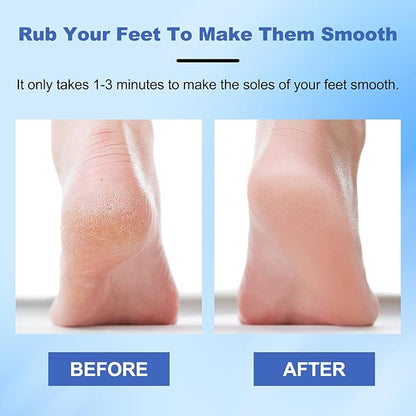 Veinsgrain Foot File, Veins Grain Foot File, Professional Foot Care Tools, Nano Glass Foot File with Non-Slip Ergonomic Handle Feet Massage Tool (Gold)