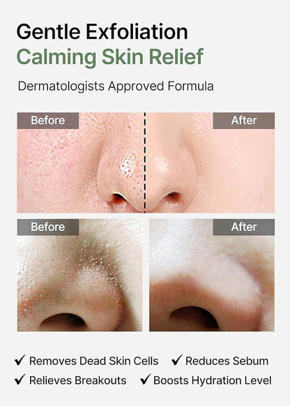 celimax Ji.Woo.Gae Heartleaf BHA Peeling Pad | Pore Care, Exfoliating Double-Side Toner Pads, Facial Peels, Hydrating, Tea Tree, For Acne Prone & Breakouts, Christmas Gift, Stocking Stuffers (60pads)