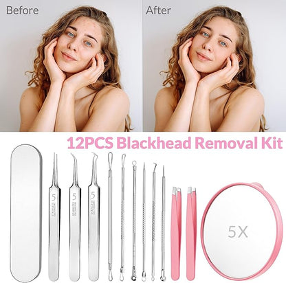 Blackhead Remover Tools Kit 12PCS: 9×Comedone Extractors, 2×Eyebrow Tweezers, 1×5X Mirror, Curved Blackhead Tweezers Kit for Removal of Blackheads, Pimples, Zit Removing, Facial & Nose Tool (Pink)