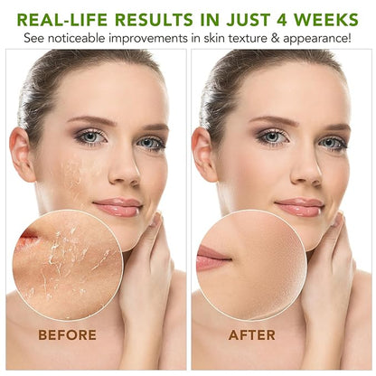 Shea Butter Raw Organic,Pure Shea Butter Unrefined for Body, Face & Hair,Long-Lasting Hydration for Dry Skin, Hair Care, DIY Lip Balm, Natural Moisturizer-100% Natural Vitamin A, E & F-7.8 oz